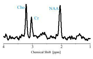 1H Spectrum