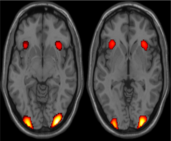 Activation after memory task